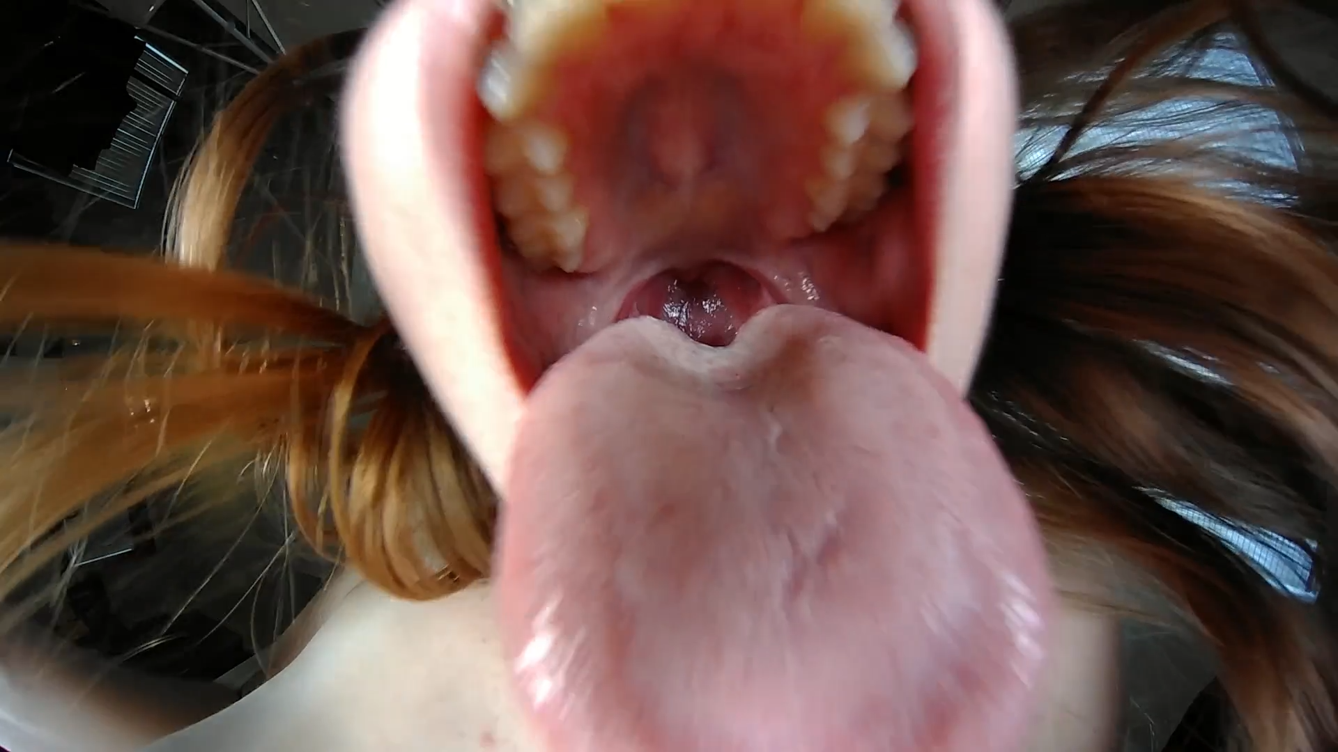 Braces Vore Tease P3 - spitfans