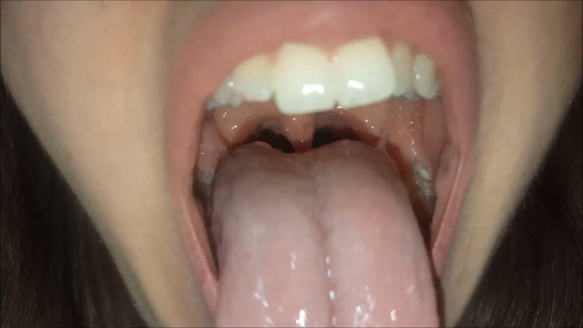 Alandra solves your emotional problems (vore)