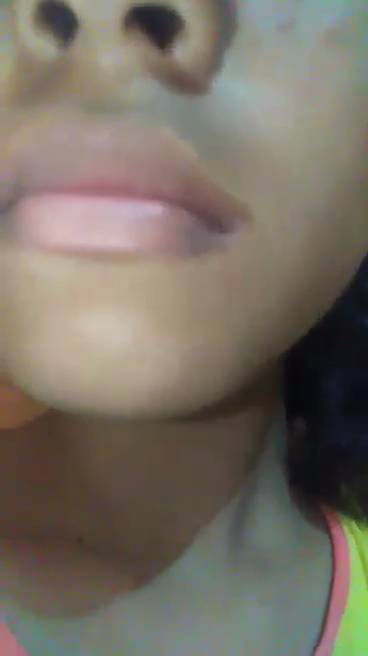 Check Mouth 1