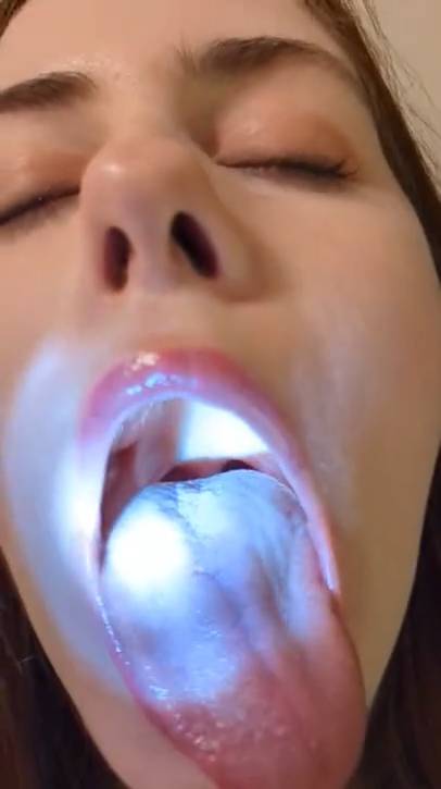 SLIT CLINIC  Oral Examination Lighting The Tongue