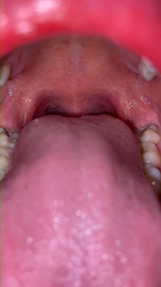 V2